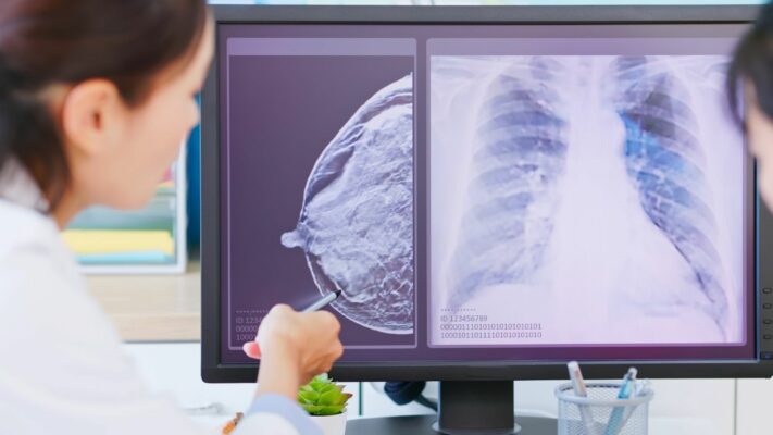 Ankara Which Department or Doctor Should You See for Breast Cancer?