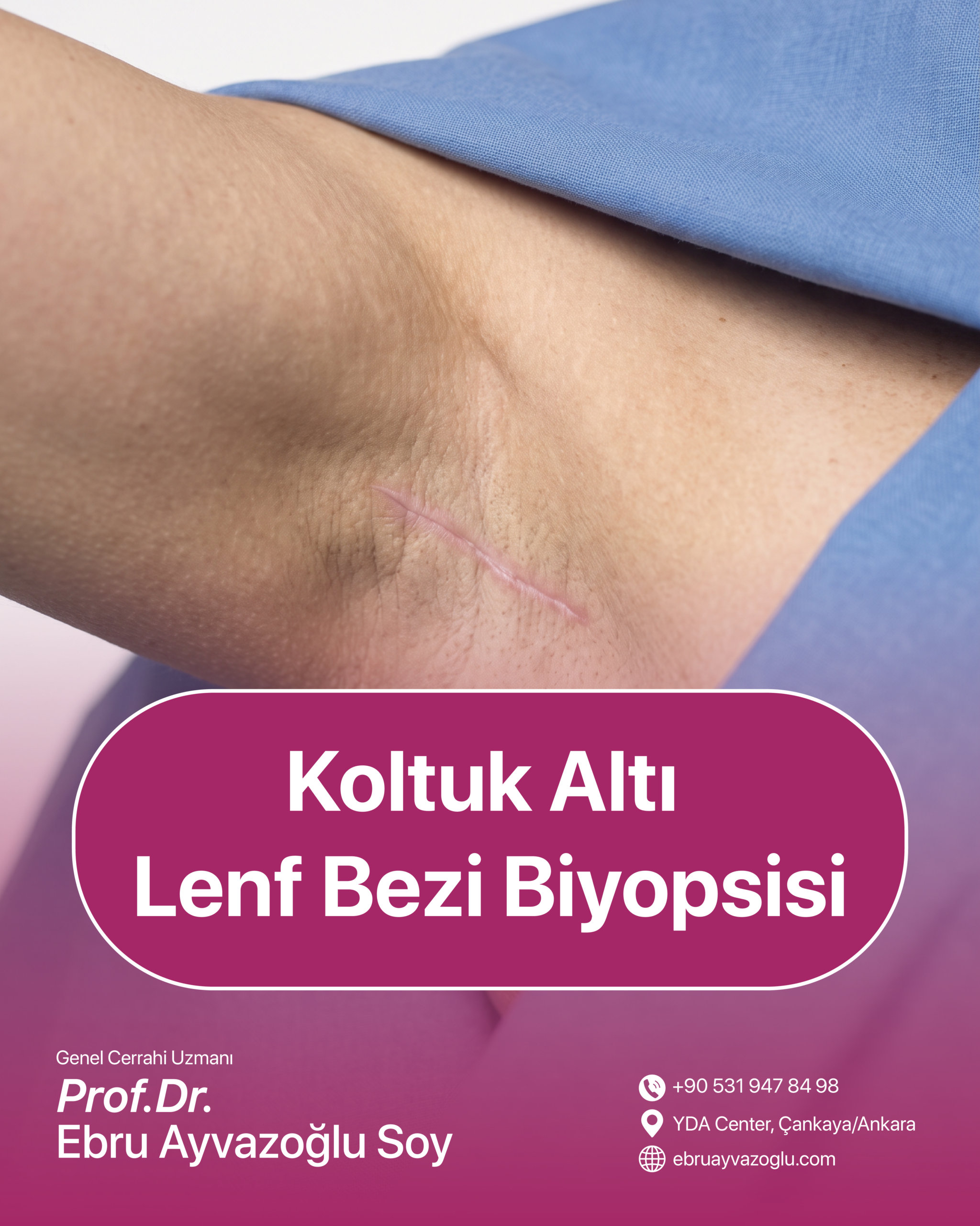 Koltuk Altı Lenf Bezi Biyopsisi