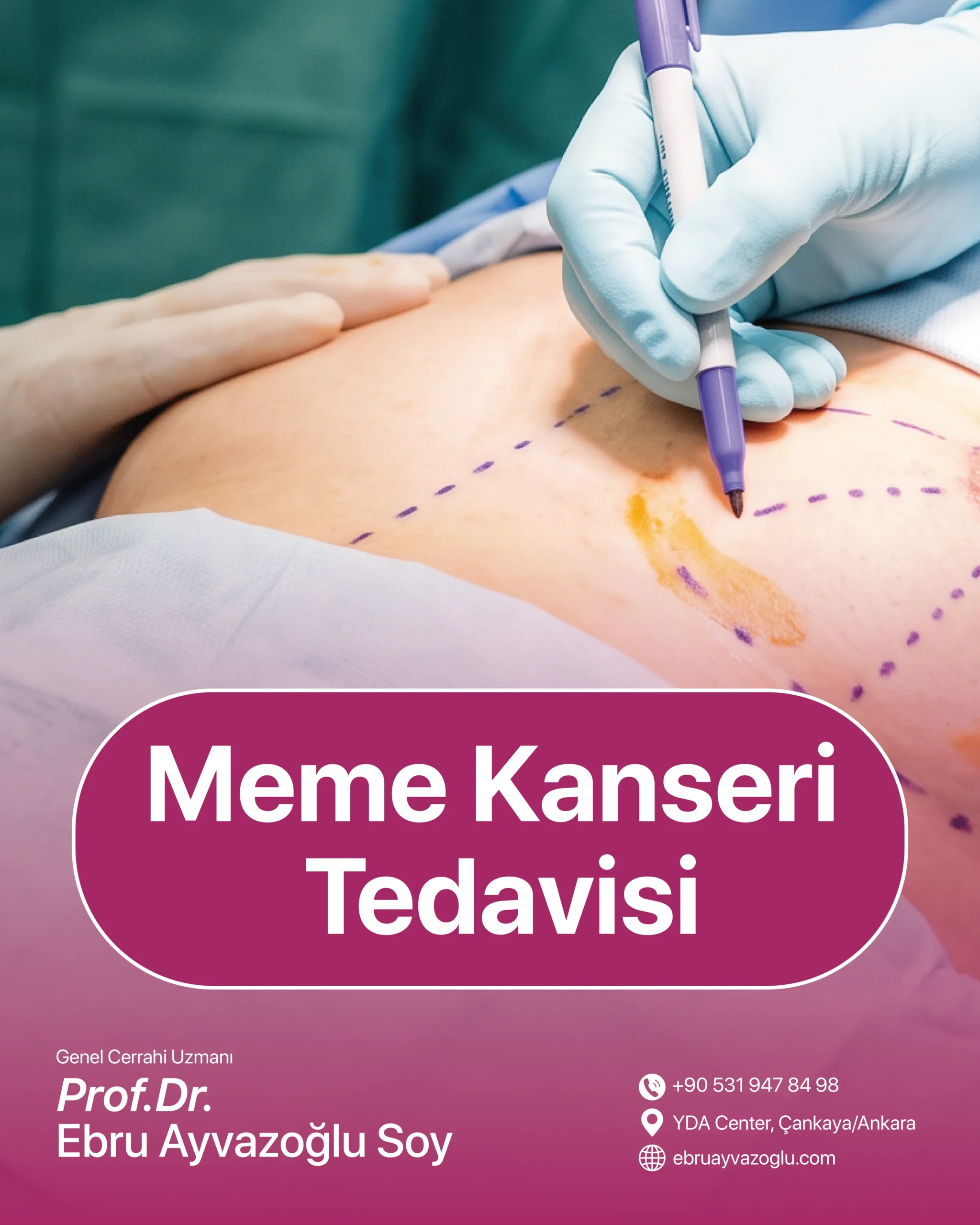 Meme Kanseri Tedavisi